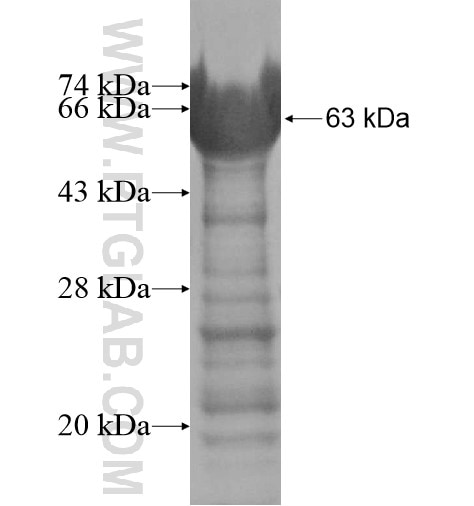 SLC9A3R2 fusion protein Ag13476 SDS-PAGE