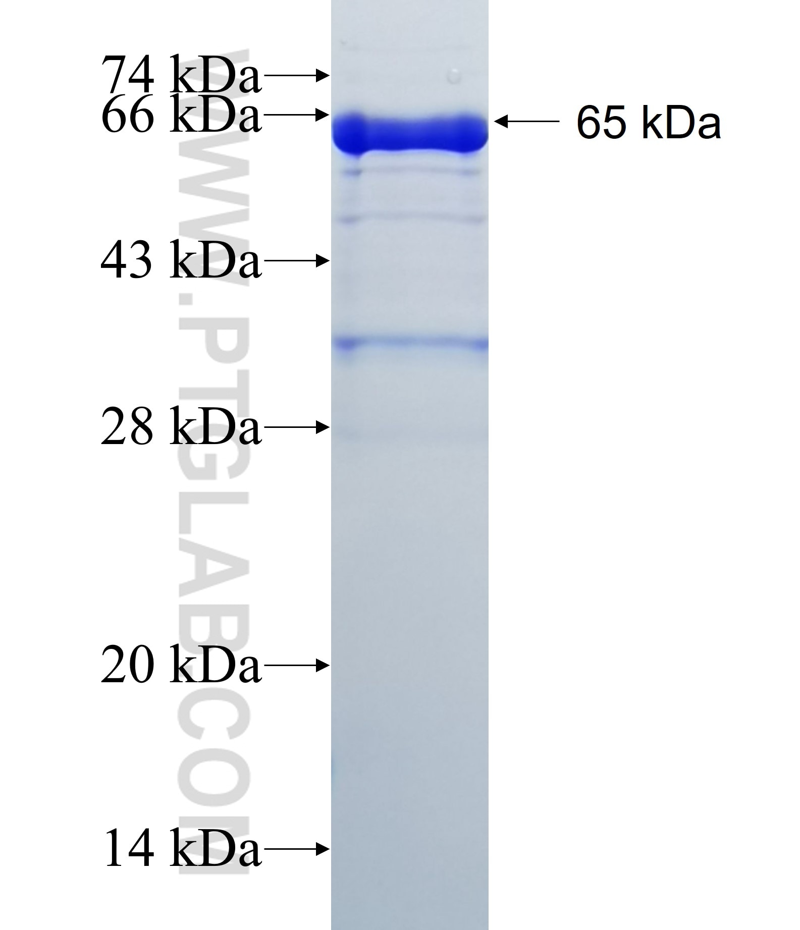 SLC9A3R2 fusion protein Ag13476 SDS-PAGE