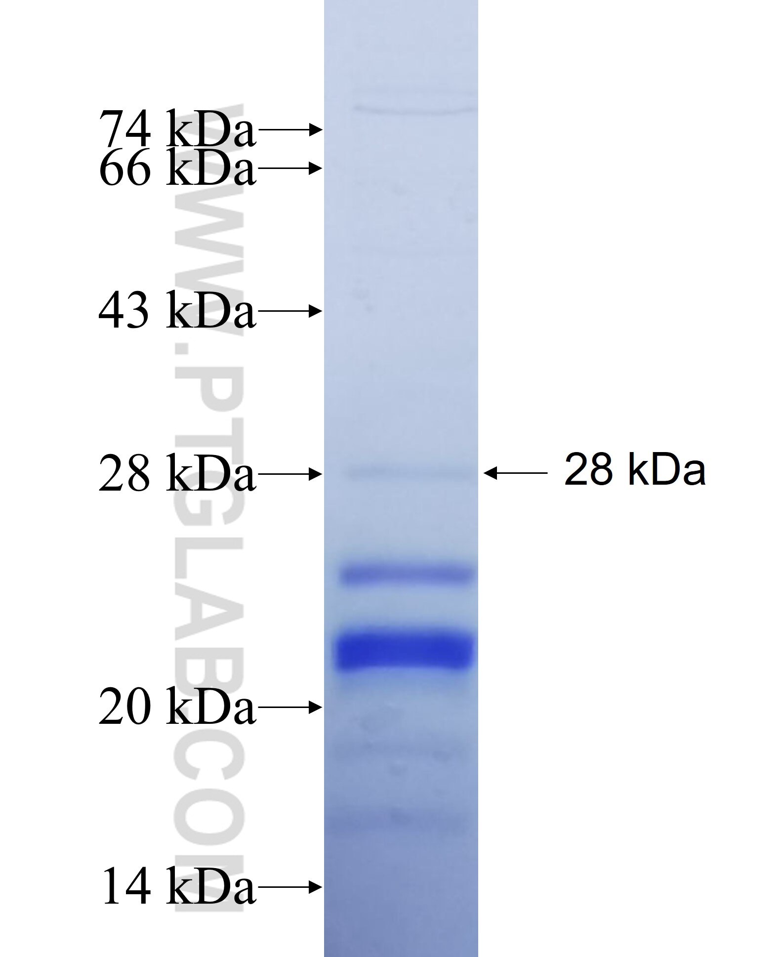 SLC9A5 fusion protein Ag27433 SDS-PAGE