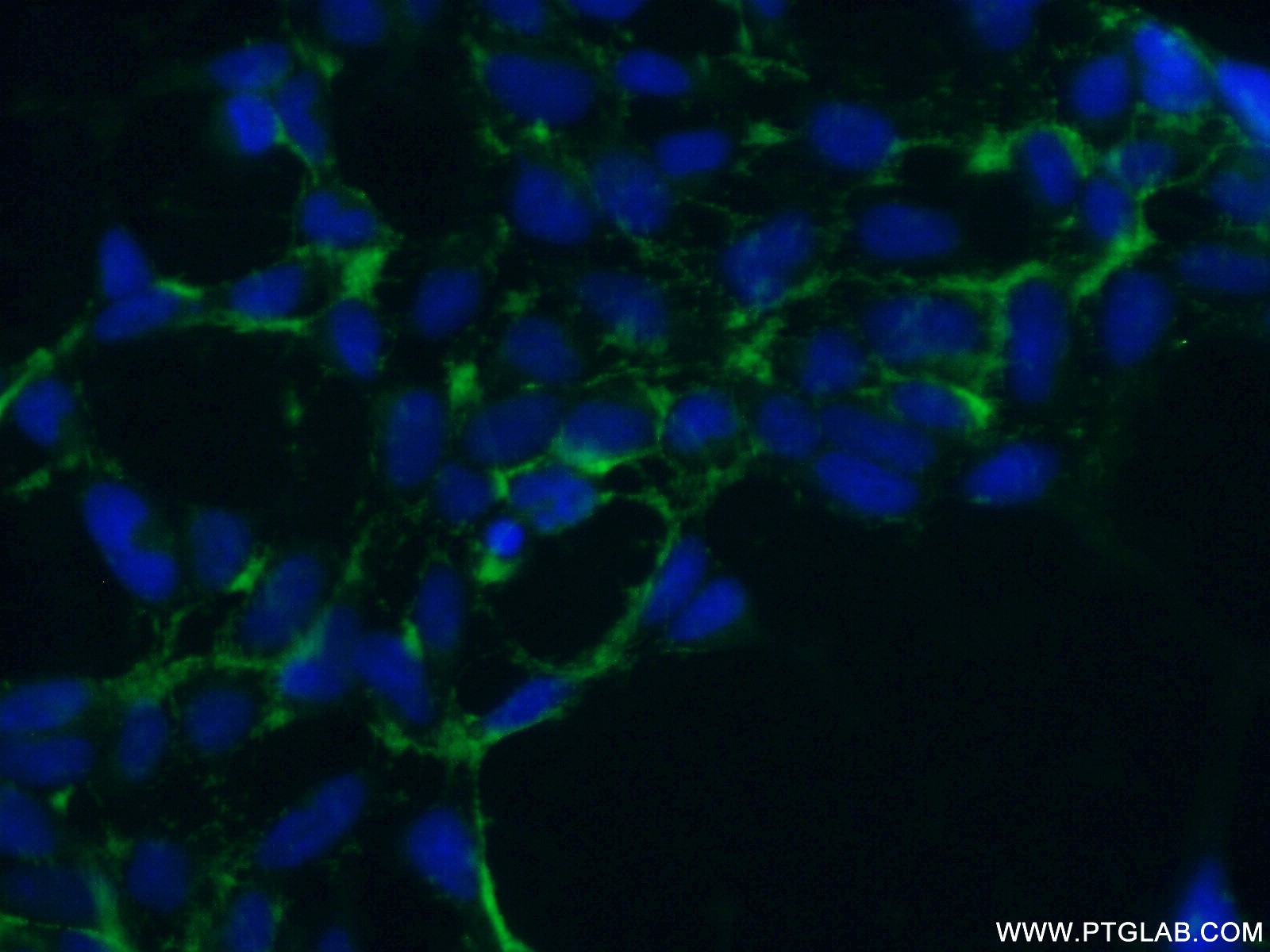 Immunofluorescence (IF) / fluorescent staining of HEK-293 cells using NHE8 Polyclonal antibody (18318-1-AP)