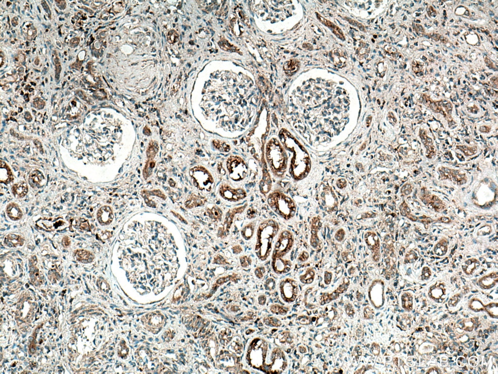 Immunohistochemistry (IHC) staining of human kidney tissue using NHE8 Polyclonal antibody (18318-1-AP)