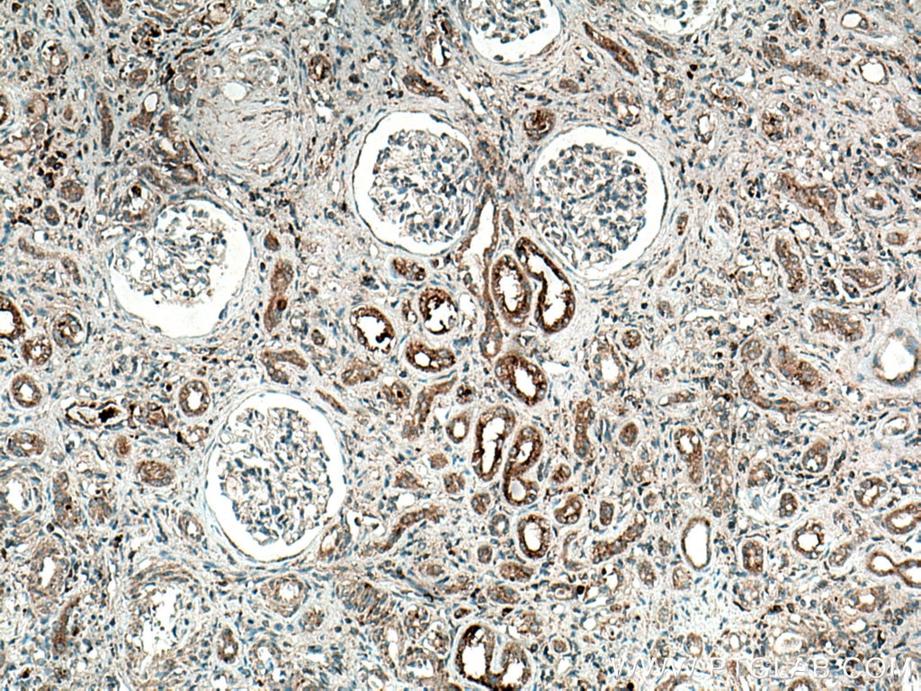 IHC staining of human kidney using 18318-1-AP