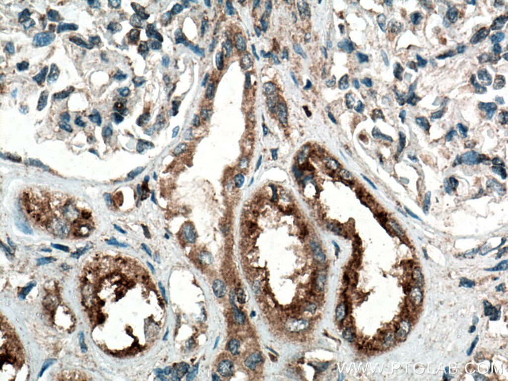 Immunohistochemistry (IHC) staining of human kidney tissue using NHE8 Polyclonal antibody (18318-1-AP)