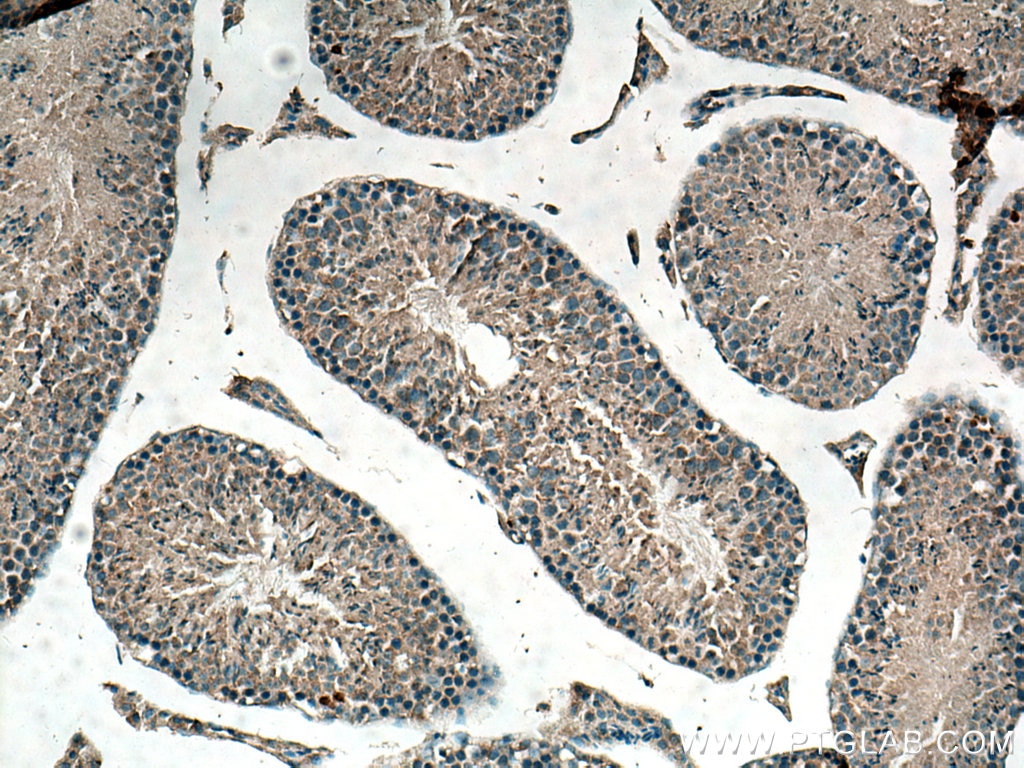 IHC staining of mouse testis using 18318-1-AP