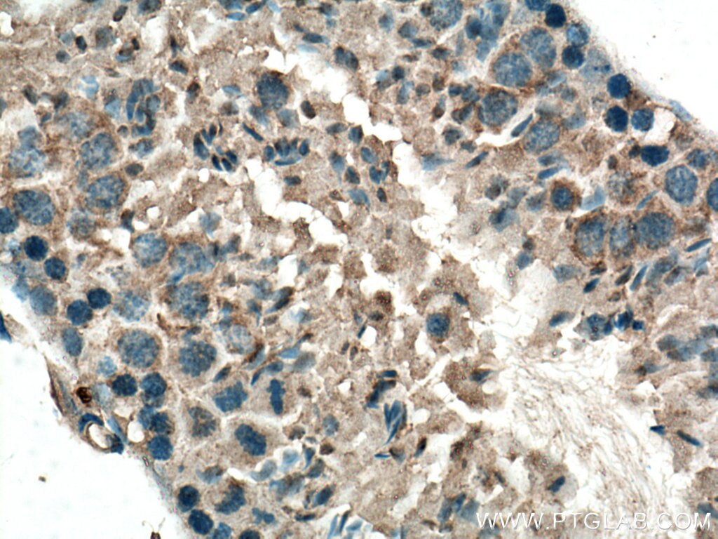 Immunohistochemistry (IHC) staining of mouse testis tissue using NHE8 Polyclonal antibody (18318-1-AP)