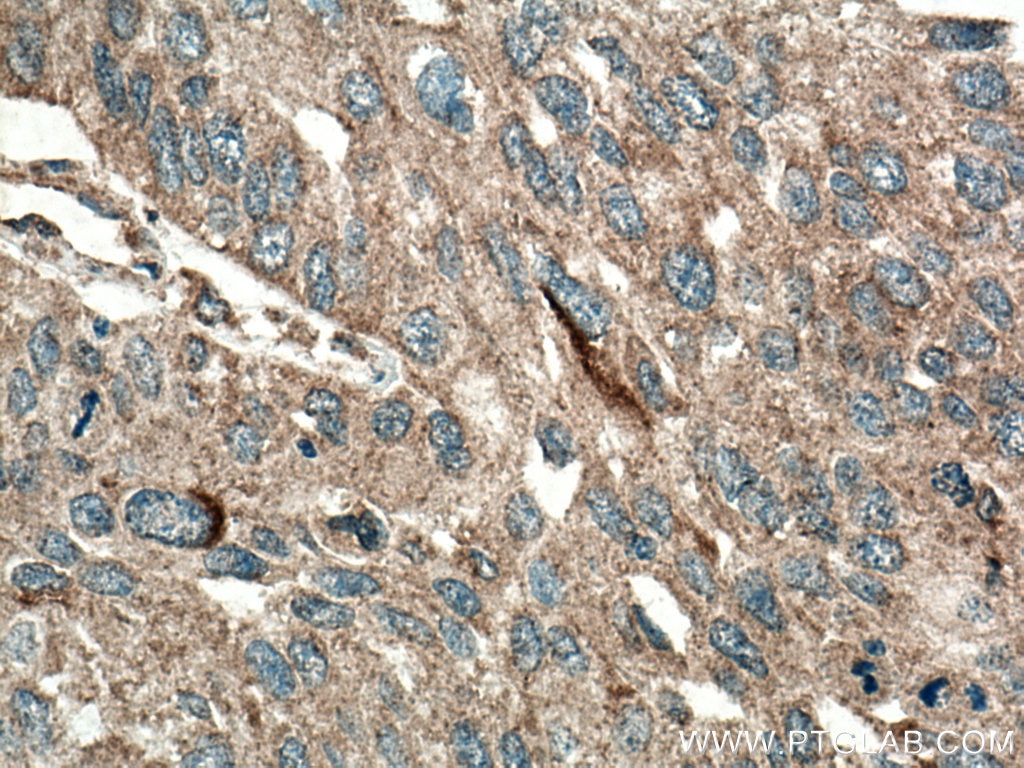 Immunohistochemistry (IHC) staining of human kidney tissue using NHE8 Polyclonal antibody (18318-1-AP)