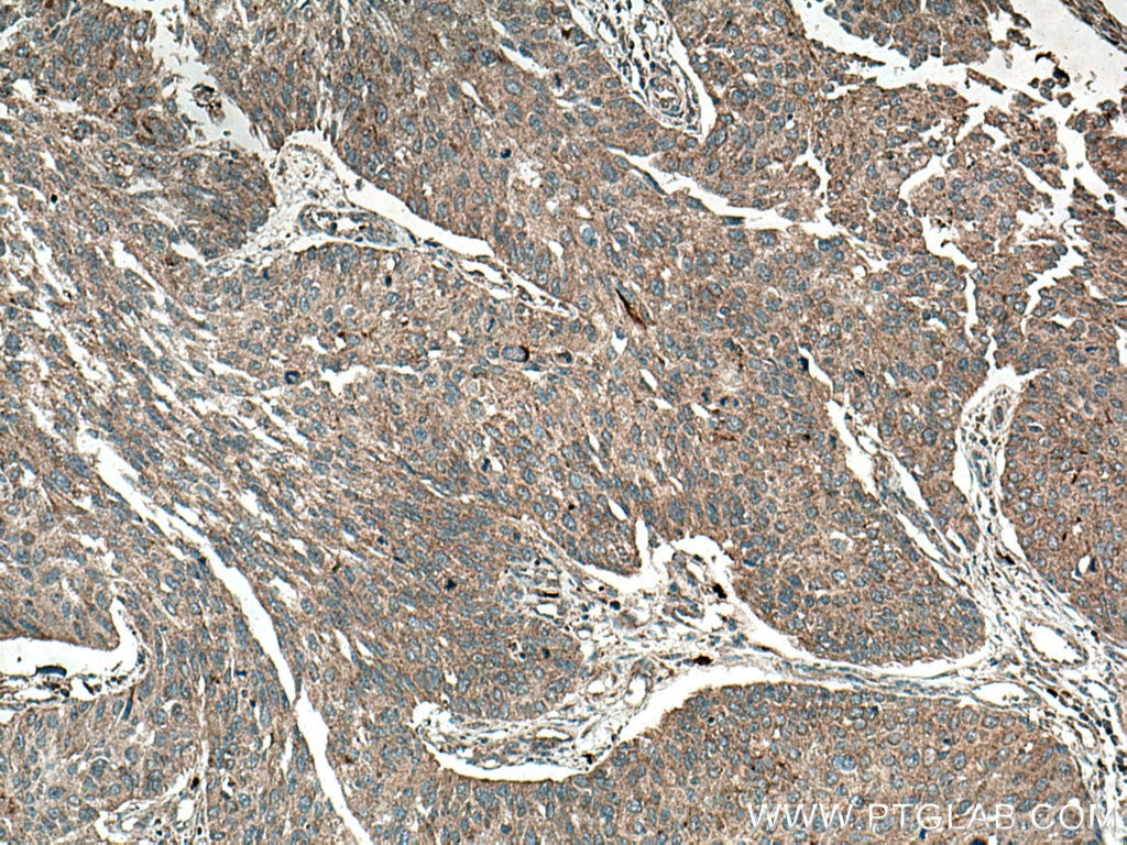 Immunohistochemistry (IHC) staining of human kidney tissue using NHE8 Polyclonal antibody (18318-1-AP)