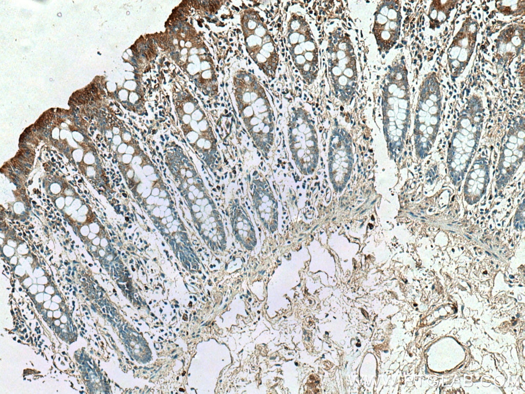 Immunohistochemistry (IHC) staining of human colon tissue using NHE8 Polyclonal antibody (18318-1-AP)