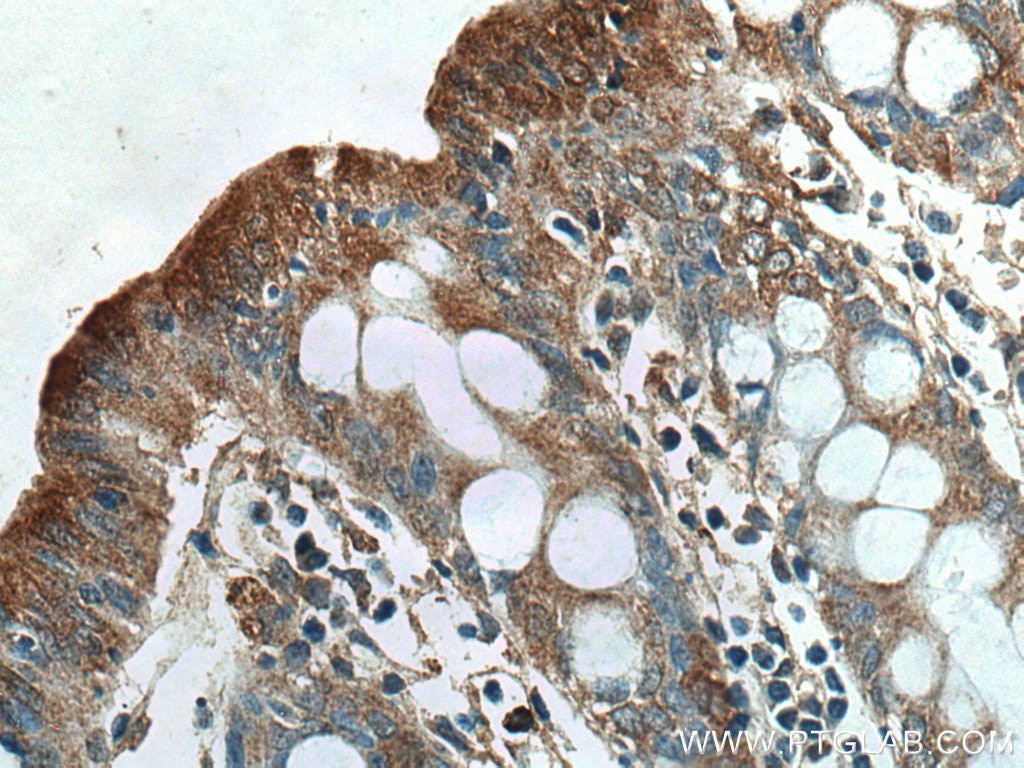 Immunohistochemistry (IHC) staining of human colon tissue using NHE8 Polyclonal antibody (18318-1-AP)