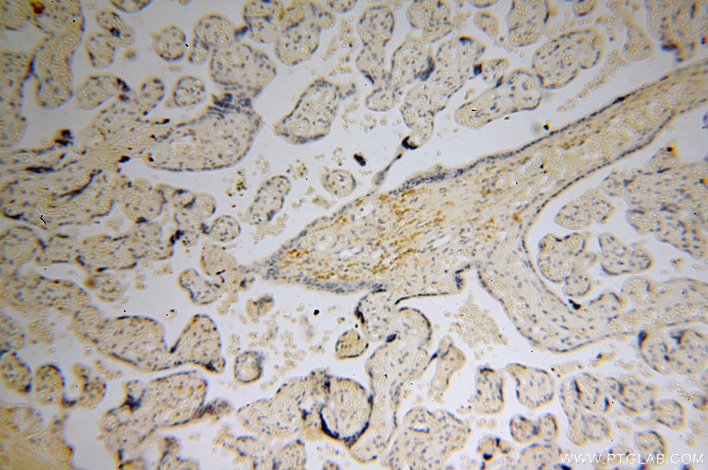 Immunohistochemistry (IHC) staining of human placenta tissue using NHE8 Polyclonal antibody (18318-1-AP)