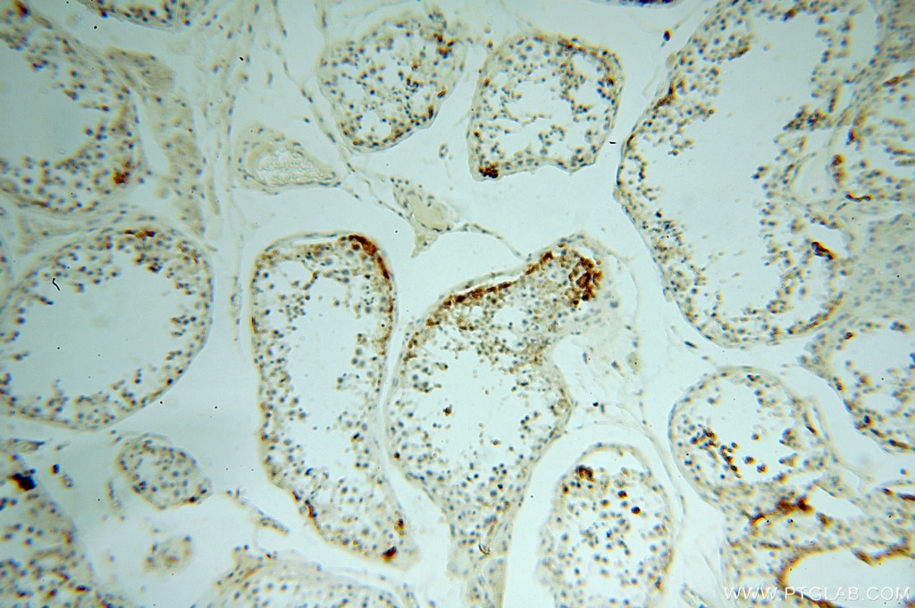 Immunohistochemistry (IHC) staining of human testis tissue using NHE8 Polyclonal antibody (18318-1-AP)