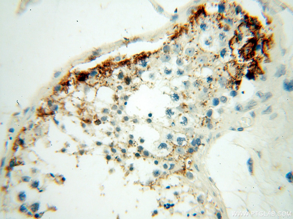 Immunohistochemistry (IHC) staining of human testis tissue using NHE8 Polyclonal antibody (18318-1-AP)