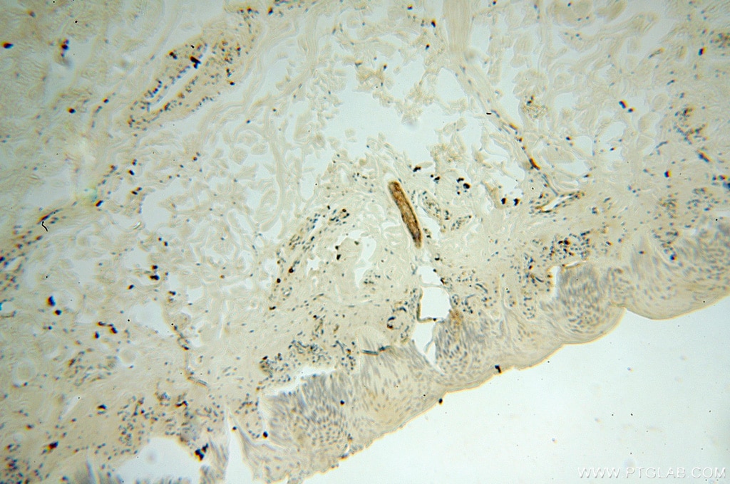 Immunohistochemistry (IHC) staining of human skin tissue using NHE8 Polyclonal antibody (18318-1-AP)