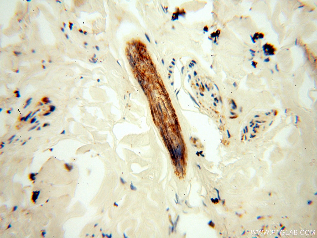 Immunohistochemistry (IHC) staining of human skin tissue using NHE8 Polyclonal antibody (18318-1-AP)