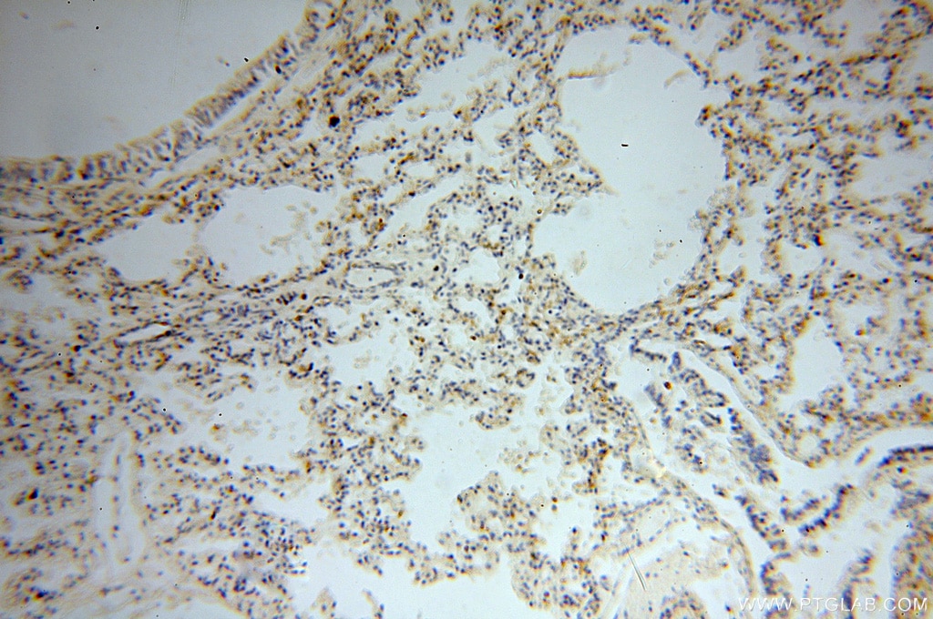 Immunohistochemistry (IHC) staining of human lung tissue using NHE8 Polyclonal antibody (18318-1-AP)