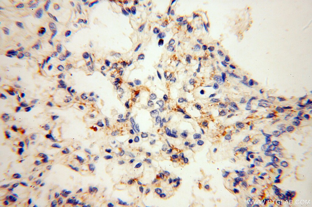 Immunohistochemistry (IHC) staining of human lung tissue using NHE8 Polyclonal antibody (18318-1-AP)