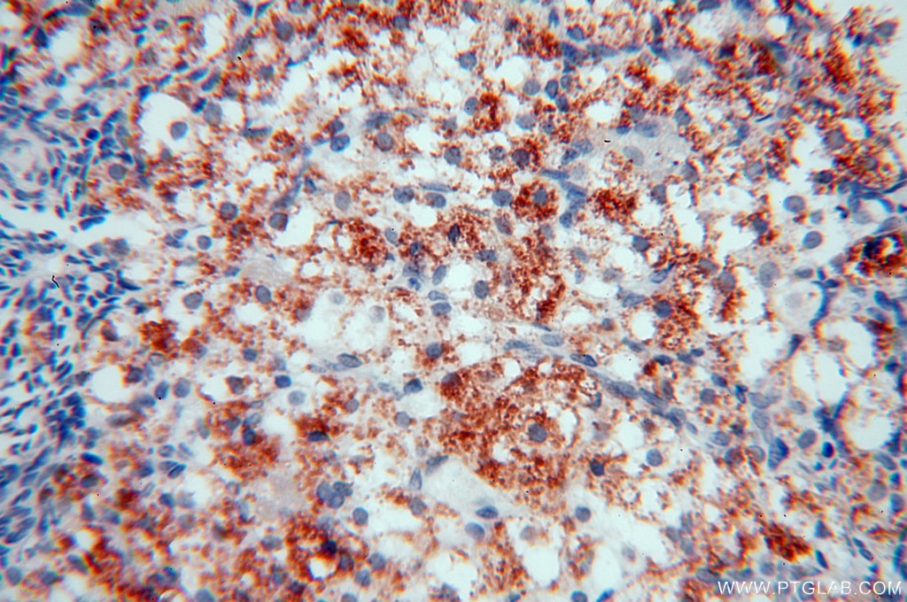 Immunohistochemistry (IHC) staining of human ovary tissue using NHE8 Polyclonal antibody (18318-1-AP)