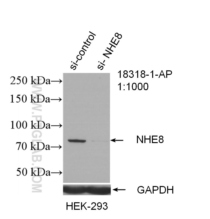 Western Blot (WB) analysis of HEK-293 cells using NHE8 Polyclonal antibody (18318-1-AP)