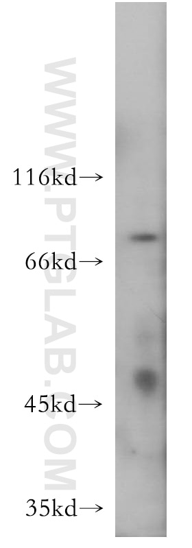 Western Blot (WB) analysis of mouse liver tissue using NHE8 Polyclonal antibody (18318-1-AP)