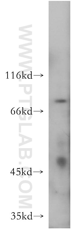 WB analysis of mouse liver using 18318-1-AP