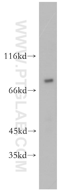 Western Blot (WB) analysis of mouse kidney tissue using NHE8 Polyclonal antibody (18318-1-AP)