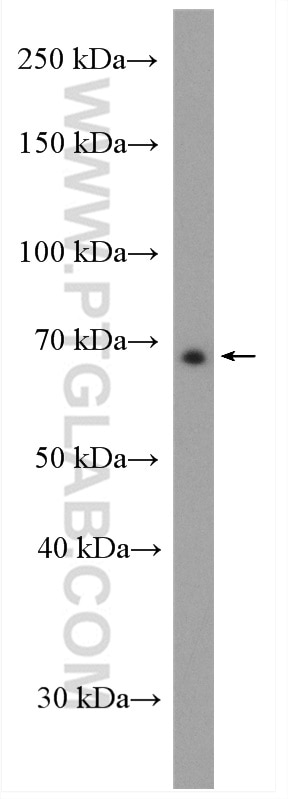 Western Blot (WB) analysis of HeLa cells using SLC9A9 Polyclonal antibody (13718-1-AP)