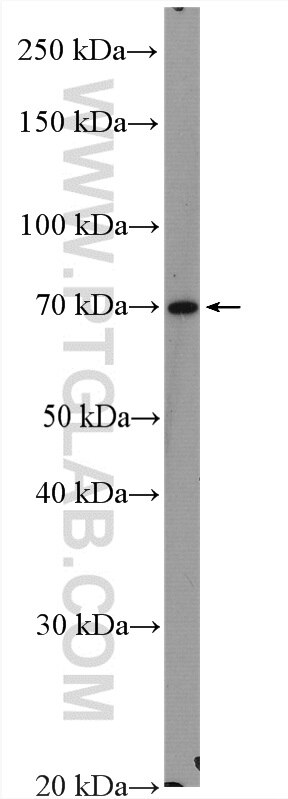 Western Blot (WB) analysis of Raji cells using SLC9A9 Polyclonal antibody (13718-1-AP)