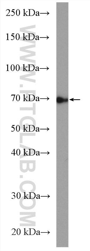 Western Blot (WB) analysis of HepG2 cells using SLC9A9 Polyclonal antibody (13718-1-AP)