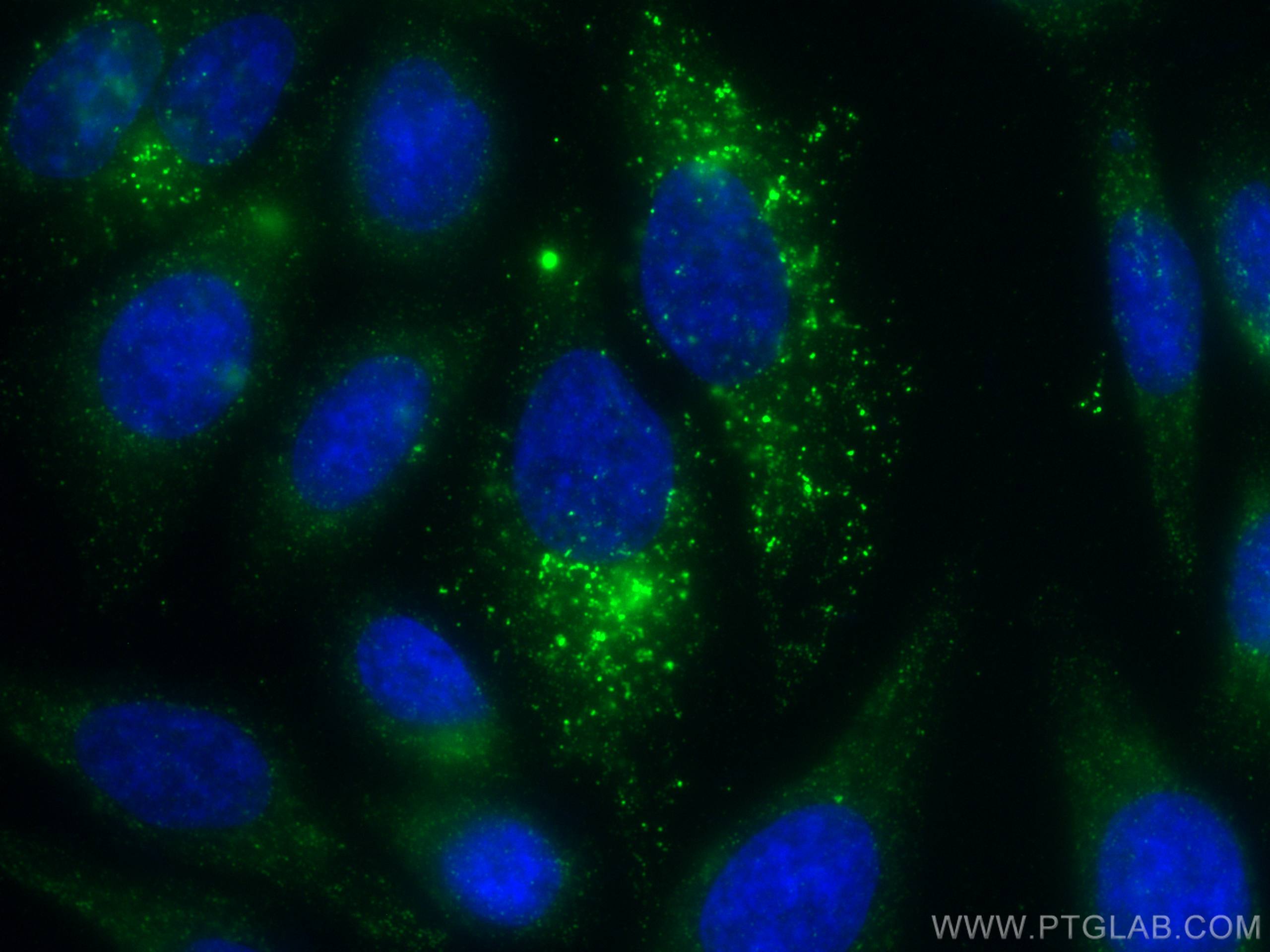 Immunofluorescence (IF) / fluorescent staining of HepG2 cells using SLC9A9 Monoclonal antibody (66577-1-Ig)