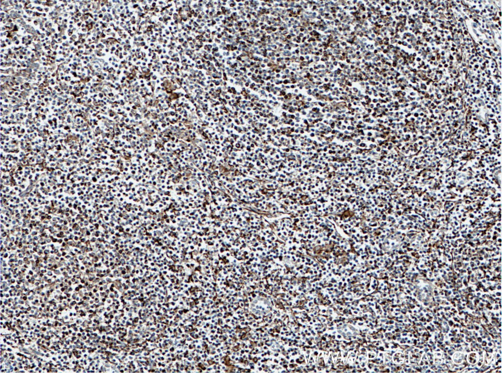 Immunohistochemistry (IHC) staining of human tonsillitis tissue using SLC9A9 Monoclonal antibody (66577-1-Ig)