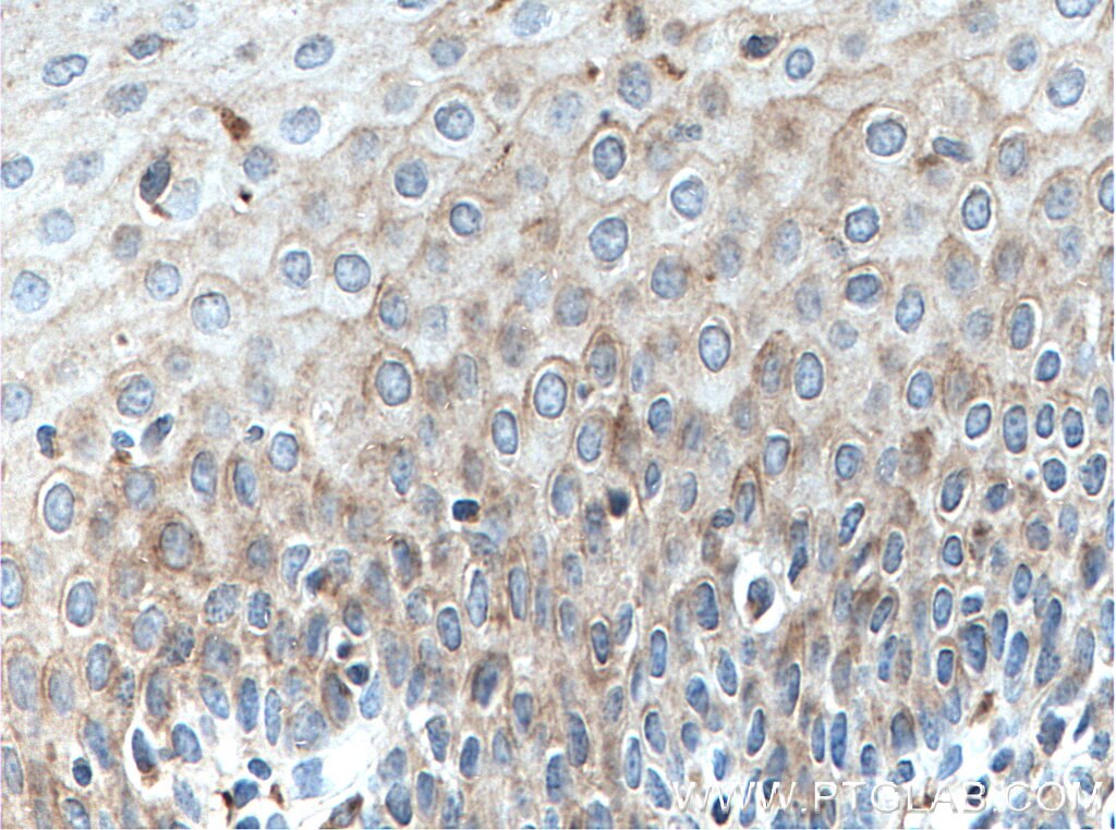 Immunohistochemistry (IHC) staining of human tonsillitis tissue using SLC9A9 Monoclonal antibody (66577-1-Ig)