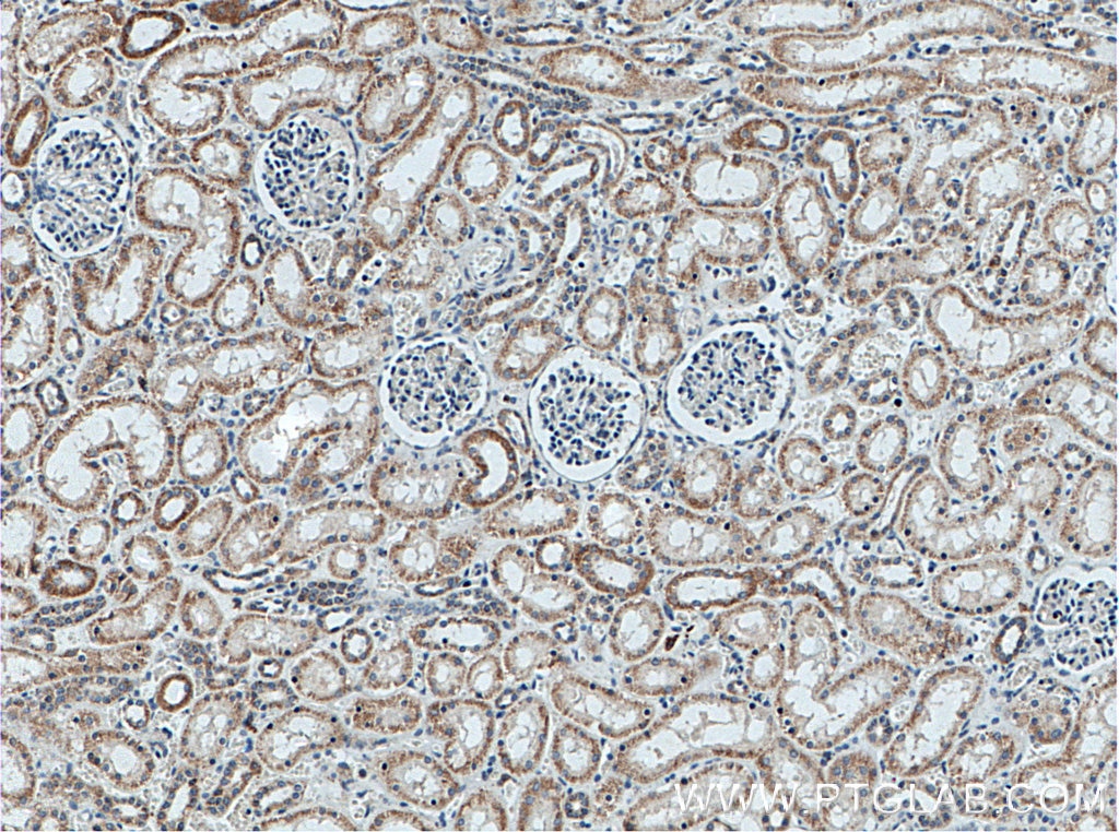 Immunohistochemistry (IHC) staining of human kidney tissue using SLC9A9 Monoclonal antibody (66577-1-Ig)