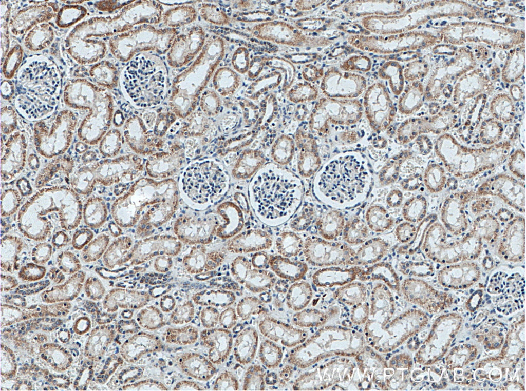 IHC staining of human kidney using 66577-1-Ig