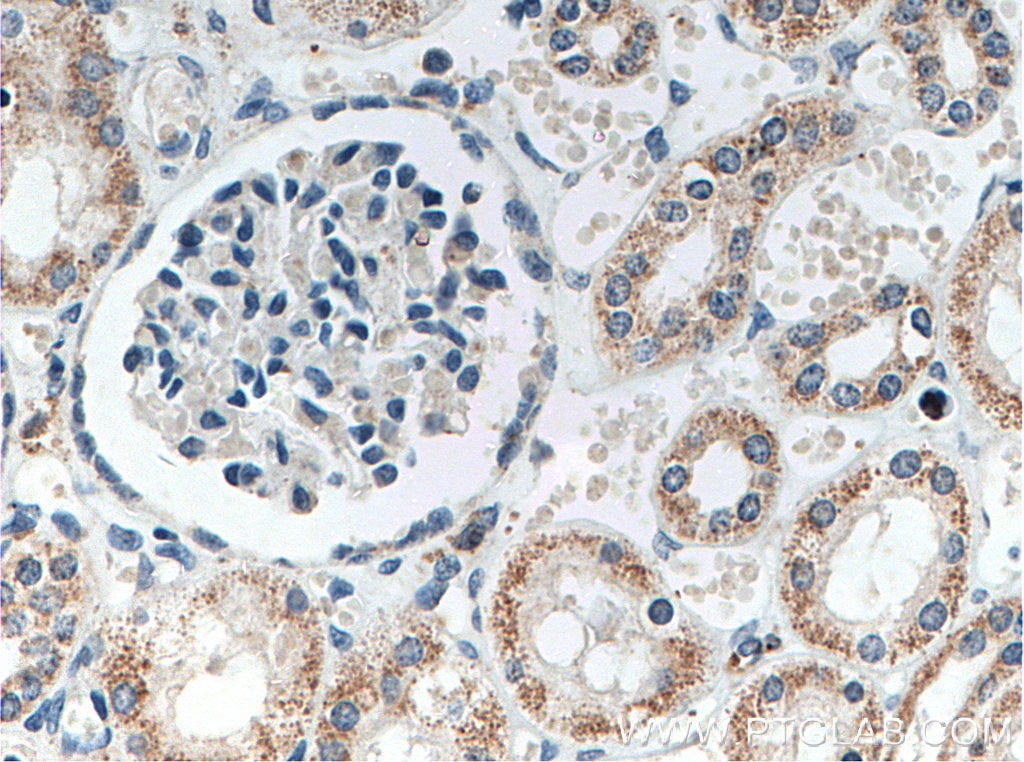Immunohistochemistry (IHC) staining of human kidney tissue using SLC9A9 Monoclonal antibody (66577-1-Ig)