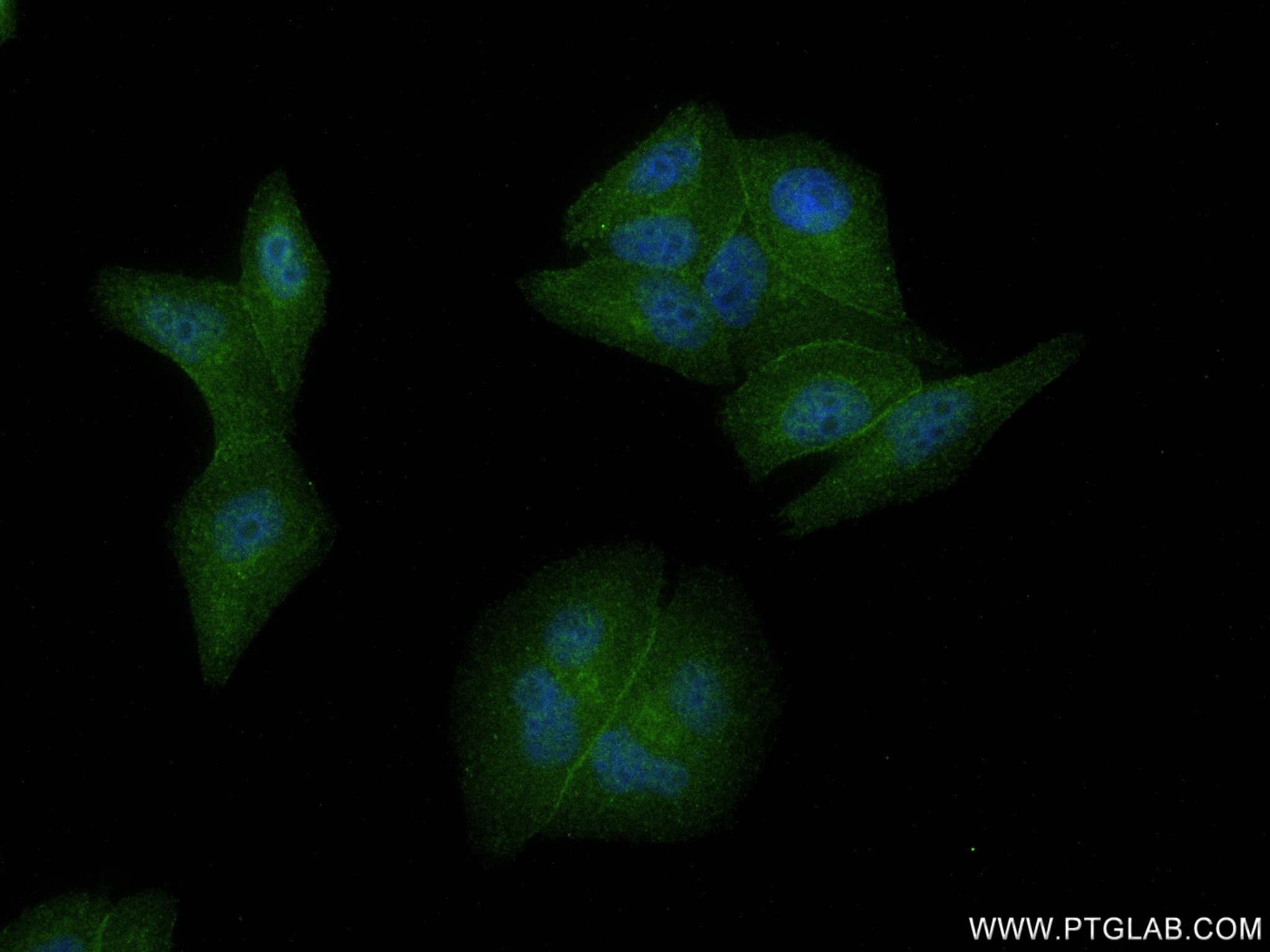 Immunofluorescence (IF) / fluorescent staining of HepG2 cells using OATP1B1/SLCO1B1 Recombinant antibody (83054-5-RR)