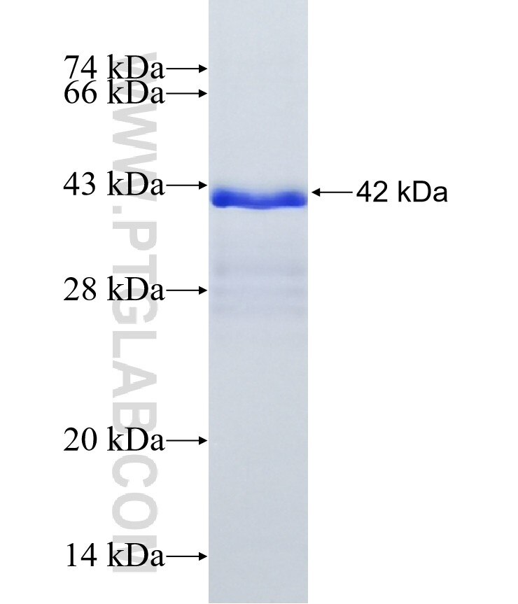SLCO1B1 fusion protein Ag16545 SDS-PAGE