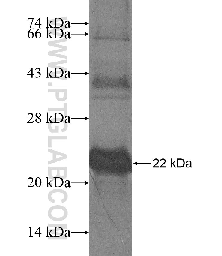 SLCO1B1 fusion protein Ag17407 SDS-PAGE