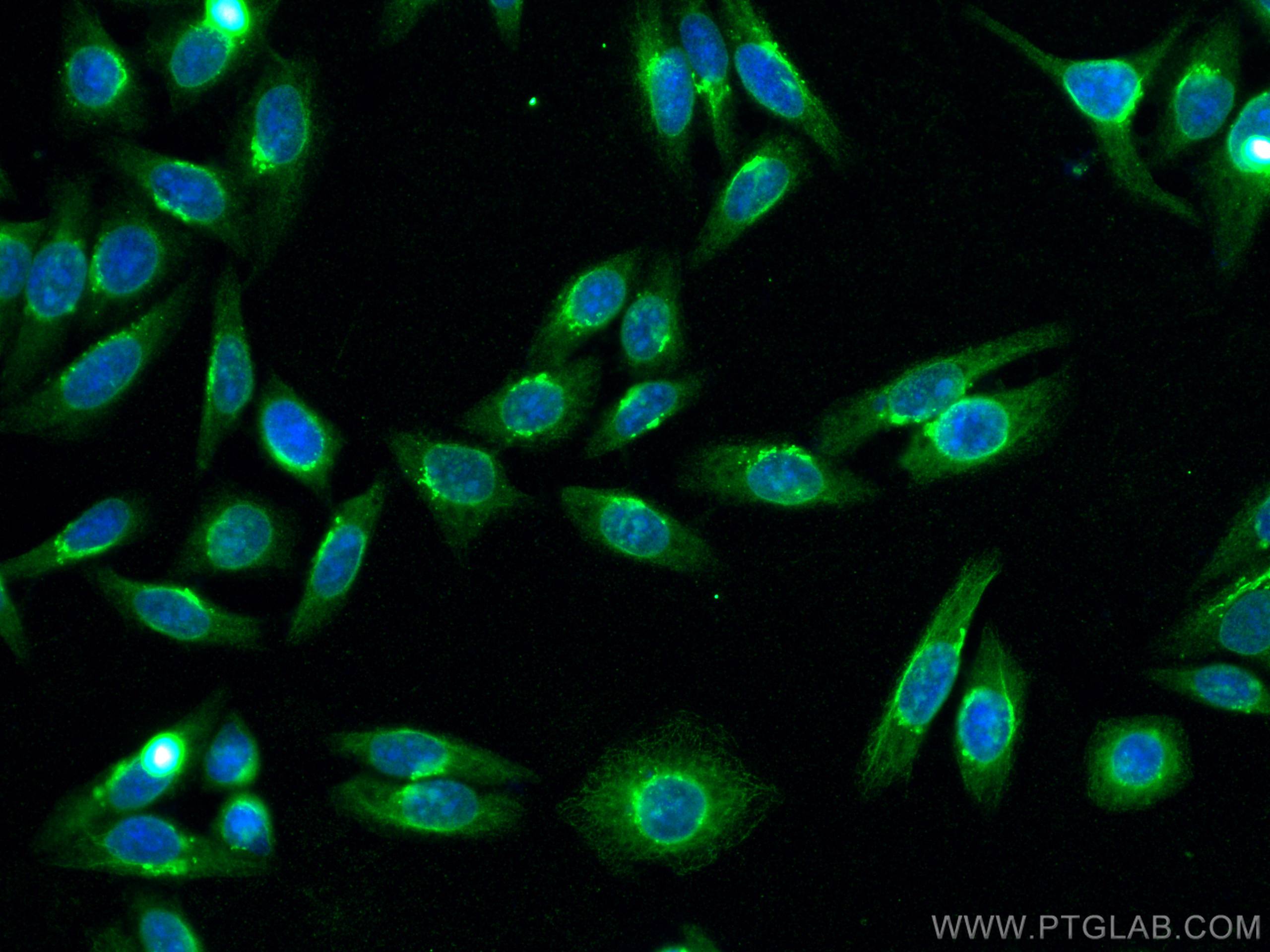 Immunofluorescence (IF) / fluorescent staining of HepG2 cells using SLCO1B3 Monoclonal antibody (66381-1-Ig)