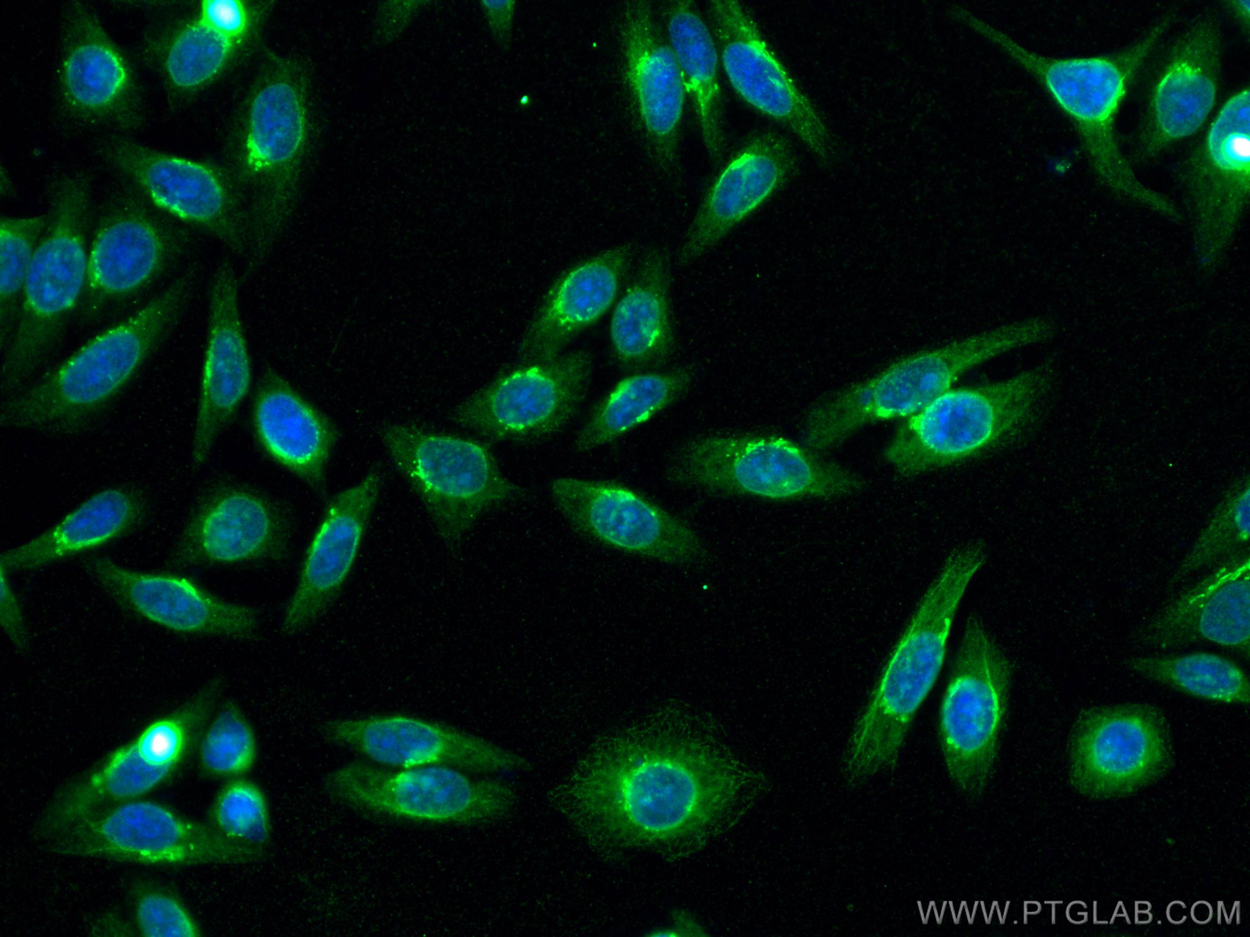 Immunofluorescence (IF) / fluorescent staining of HepG2 cells using SLCO1B3/OATP1B3 Monoclonal antibody (66381-1-Ig)