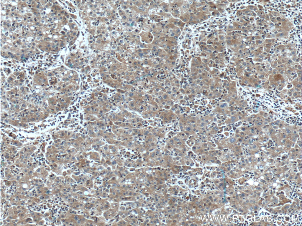 SLCO1B3/OATP1B3
