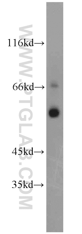 Western Blot (WB) analysis of mouse liver tissue using PGT Polyclonal antibody (14327-1-AP)