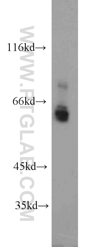 Western Blot (WB) analysis of mouse heart tissue using PGT Polyclonal antibody (14327-1-AP)