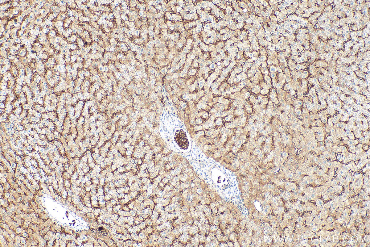Immunohistochemistry (IHC) staining of human liver tissue using SLCO2B1 Polyclonal antibody (55180-1-AP)