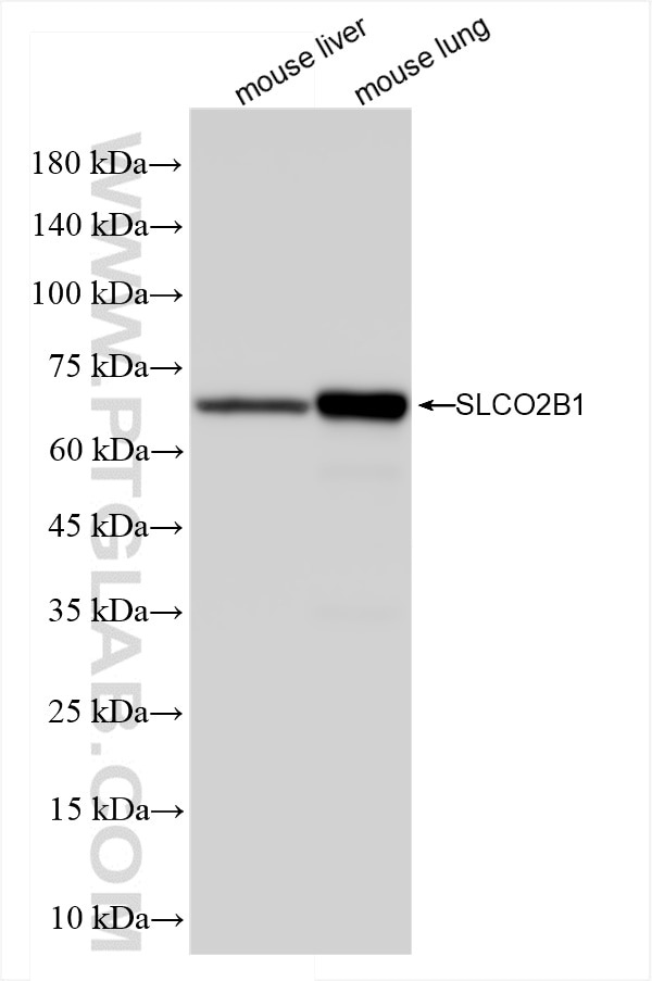 Western Blot (WB) analysis of various lysates using SLCO2B1 Recombinant antibody (84353-1-RR)