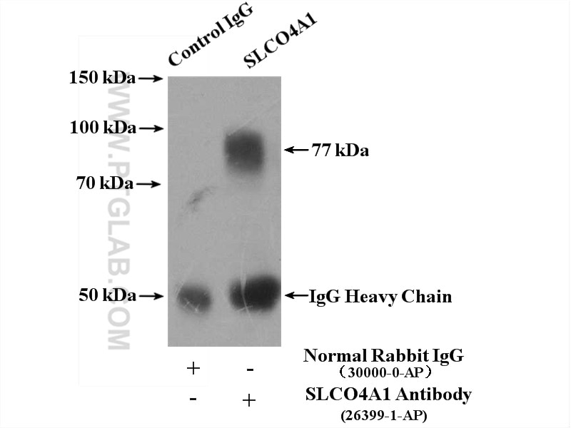 Immunoprecipitation (IP) experiment of L02 cells using SLCO4A1 Polyclonal antibody (26399-1-AP)