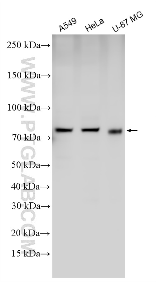 Various lysates were subjected to SDS PAGE followed by western blot with 26399-1-AP (SLCO4A1 antibody) at dilution of 1:600 incubated at room temperature for 1.5 hours. Western Blot (WB) analysis of various lysates using SLCO4A1 Polyclonal antibody (26399-1-AP)