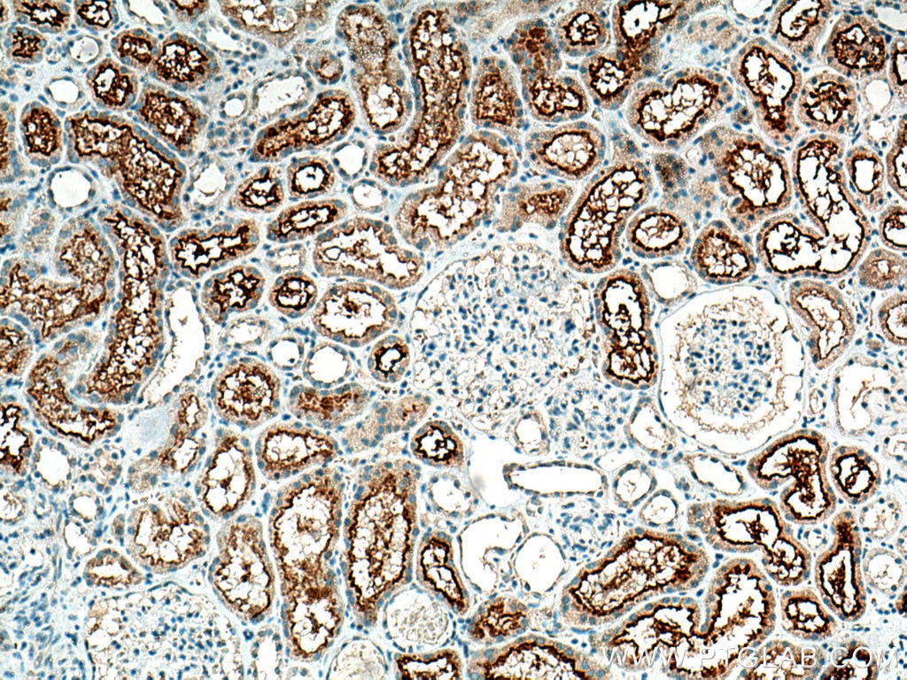 Immunohistochemistry (IHC) staining of human kidney tissue using SLCO4C1 Polyclonal antibody (24584-1-AP)