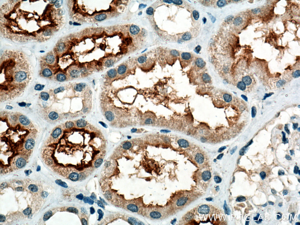 Immunohistochemistry (IHC) staining of human kidney tissue using SLCO4C1 Polyclonal antibody (24584-1-AP)