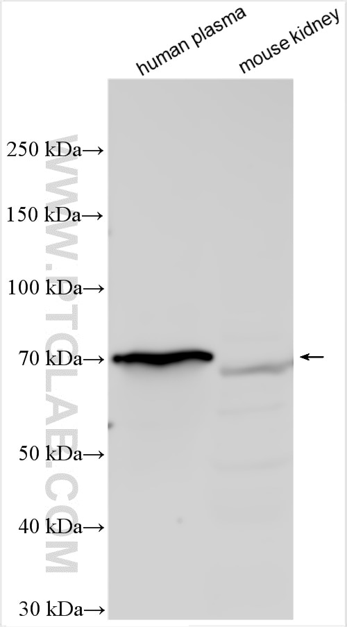 Western Blot (WB) analysis of various lysates using SLCO4C1 Polyclonal antibody (24584-1-AP)