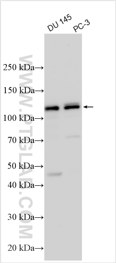 Western Blot (WB) analysis of various lysates using OATP5A1/SLCO5A1 Polyclonal antibody (25744-1-AP)